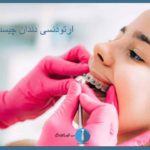 ارتودنسی چیست؟