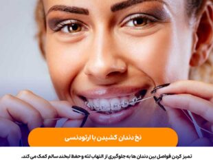نخ دندان کشیدن با ارتودنسی