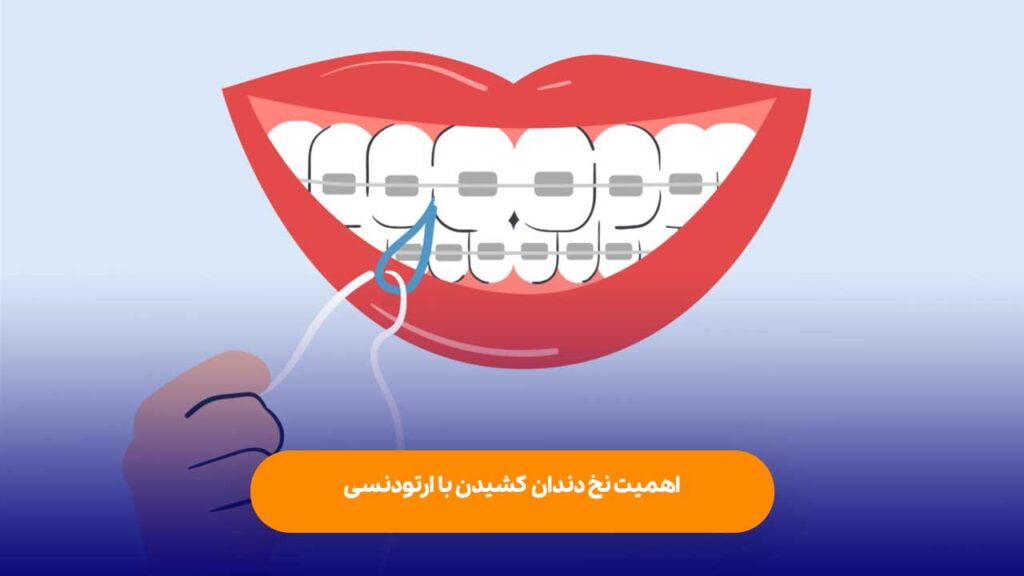 اهمیت نخ دندان کشیدن با بریس