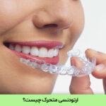 ارتودنسی متحرک