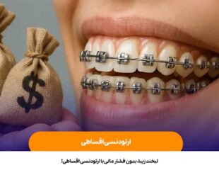 ارتودنسی اقساطی