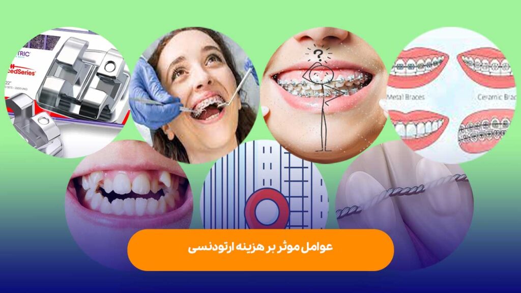 چرا هزینه ارتودنسی بالاست؟