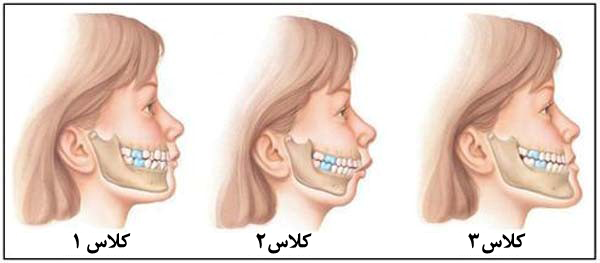 ارتودنسی کامفولاژ-1