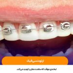 ارتودنسی فیک