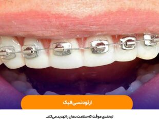 ارتودنسی فیک