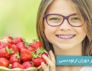 تغذیه در دوران ارتودنسی