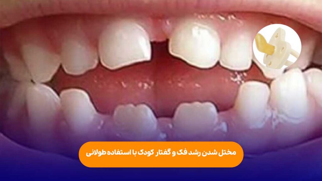 تاثیر استفاده طولانی مدت بر رشد فک و گفتار کودک