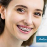 ارتودنسی بزرگسالان