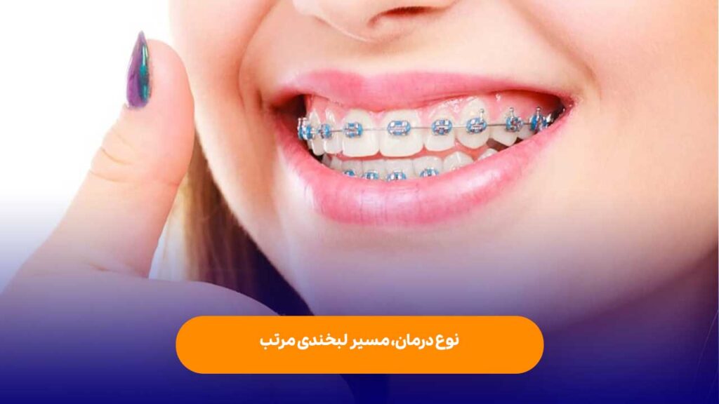 ارتودنسی ارزان