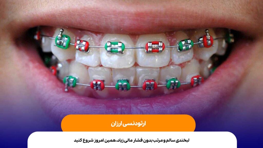 ارتودنسی ارزان