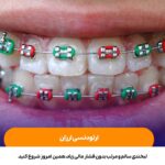 ارتودنسی ارزان