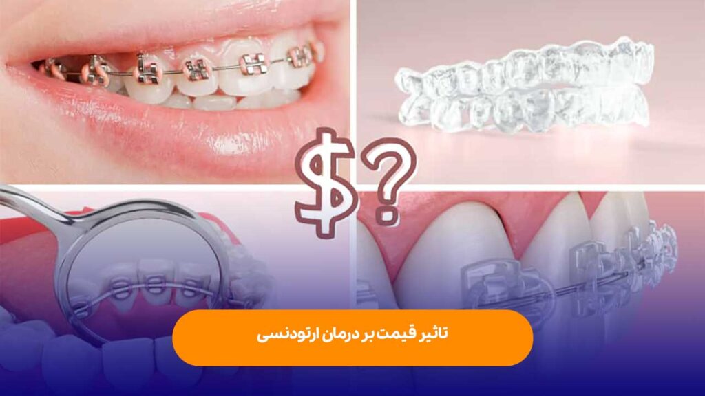 طول درمان ارتودنسی و تاثیر قیمت بر آن ارزان بودن آن