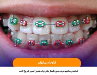 ارتودنسی ارزان