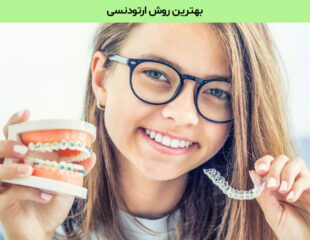 بهترین روش ارتودنسی