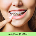 مشکلات قابل حل با ارتودنسی