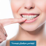 ارتودنسی سرامیکی