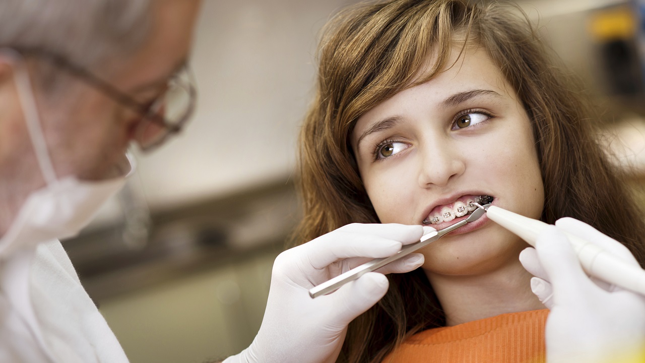 چکاپ و بررسی دندان ها در حین ارتودنسی