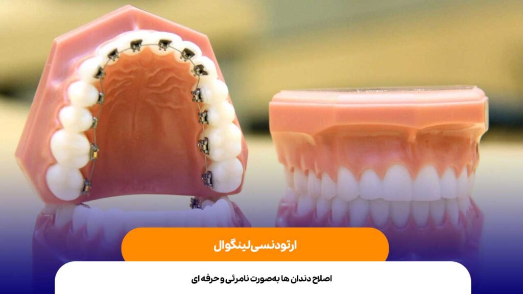 ارتودنسی لینگوال