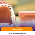 ارتودنسی لینگوال