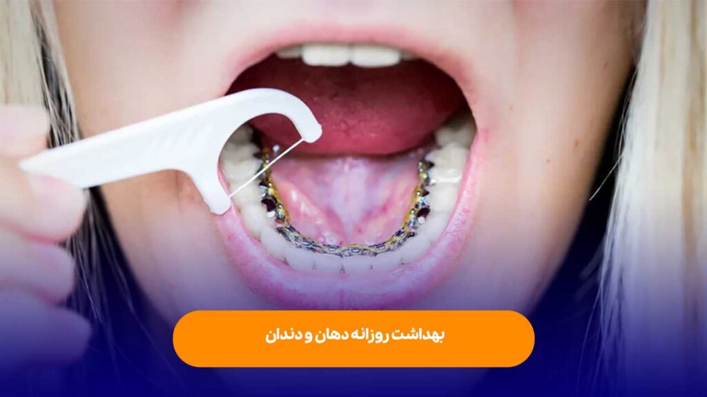 بهداشت روزانه دهان و دندان 