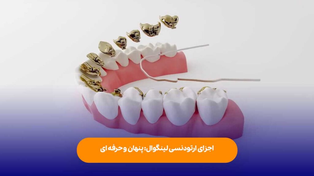 اجزا ارتودنسی لینگوال