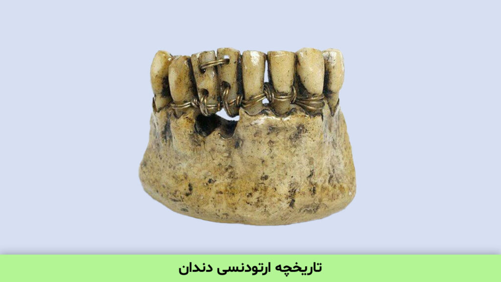 تاریخچه ارتودنسی دندان