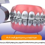 هزینه ارتودنسی دندان