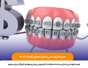 هزینه ارتودنسی دندان