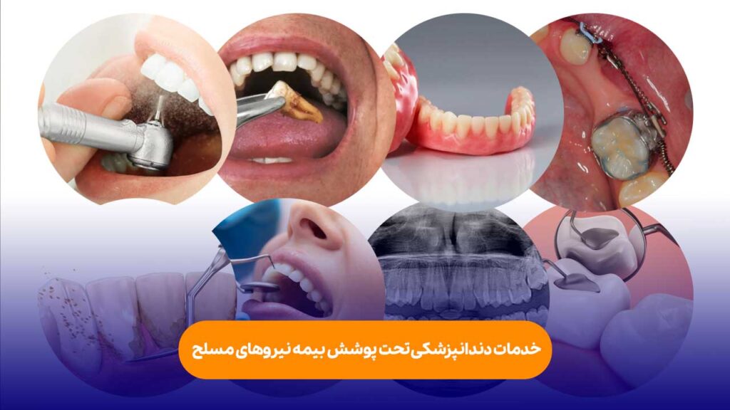 خدمات دندانپزشکی تحت پوشش بیمه نیروهای مسلح
