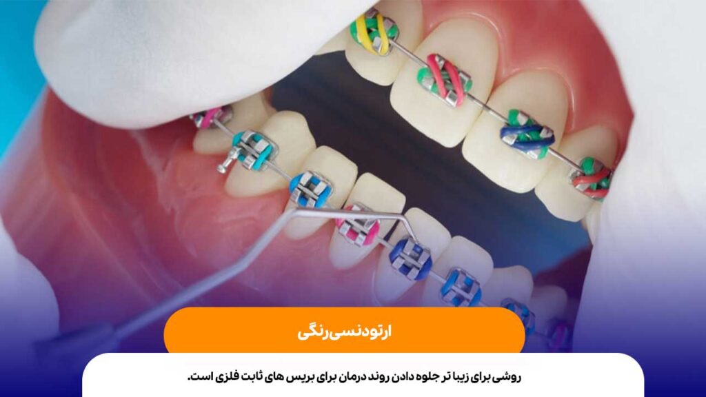 ارتودنسی رنگی