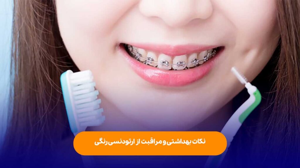 نکات بهداشتی و مراقبت از ارتودنسی رنگی