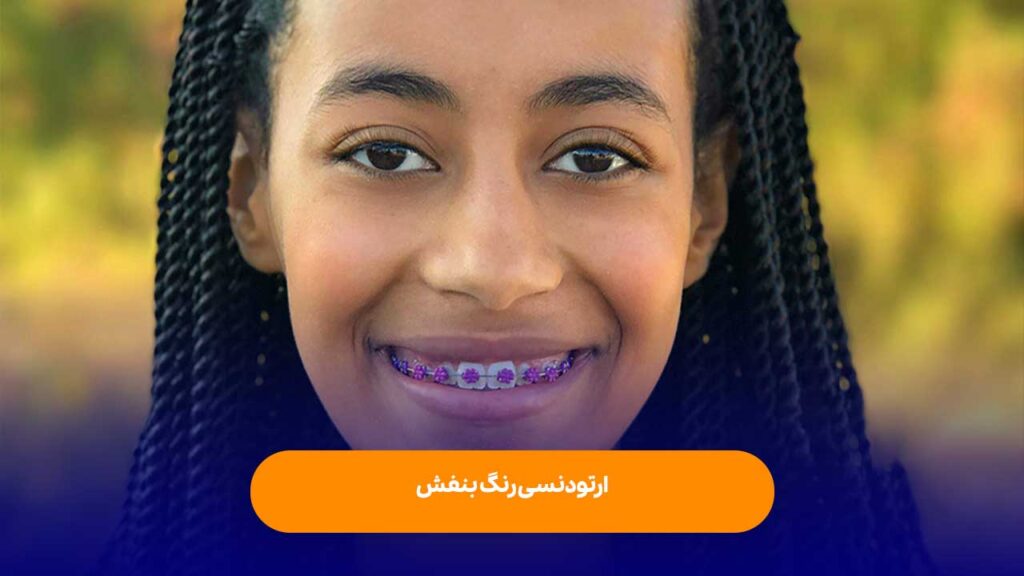 ارتودنسی بنفش