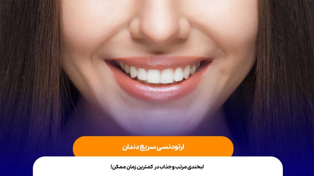 ارتودنسی سربع دندان