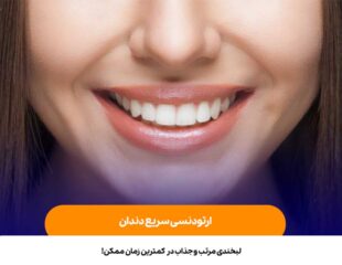 ارتودنسی سربع دندان